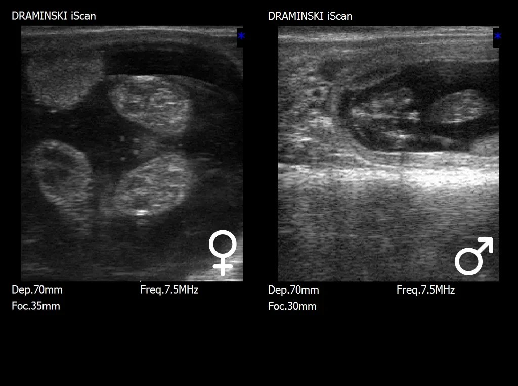 Ultrasound examination for fetal sex determination in cows